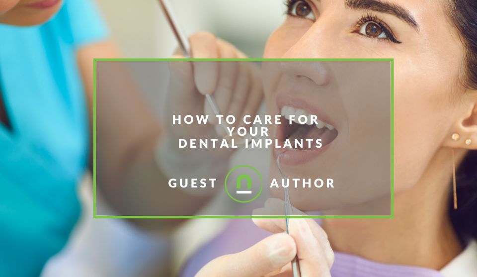 How to Care for Your Dental Implants nichemarket