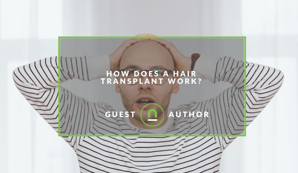 How Does A Hair Transplant Work? - nichemarket