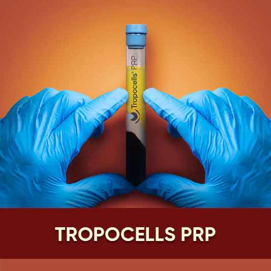Tropocells PRP is a premium platelet-rich plasma system designed for safe, efficient, and high-yield regenerative treatments.