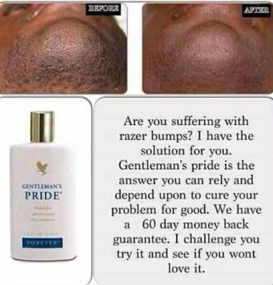 Gentleman's pride helps to replenishes razor bump prone skin. Non alcoholic  after shave that is Aloe based. Safe to use on face and back of the head