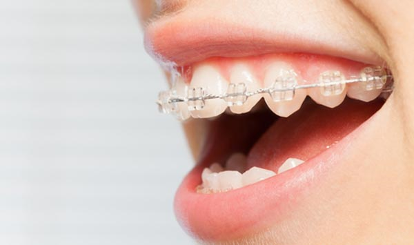 Cape Town based orthodontist